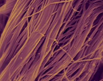 Cardiac Biomarkers Detection for Myocardial Infarction