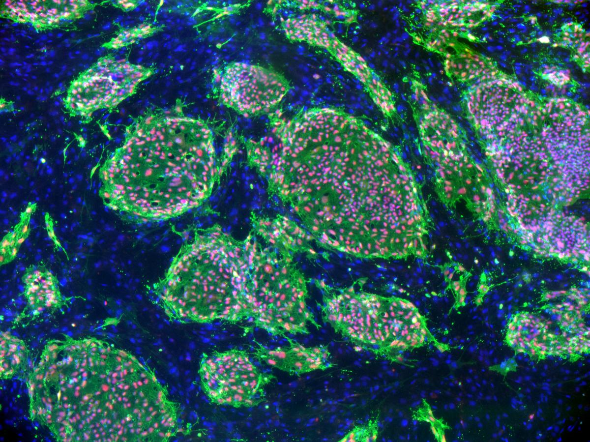 Embryotoxicity