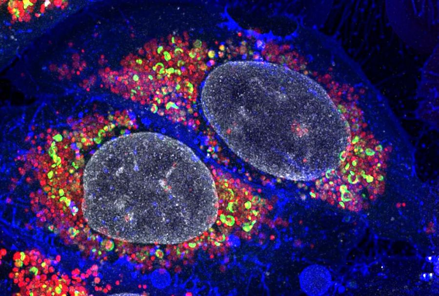 Functional Cell Stress Assays